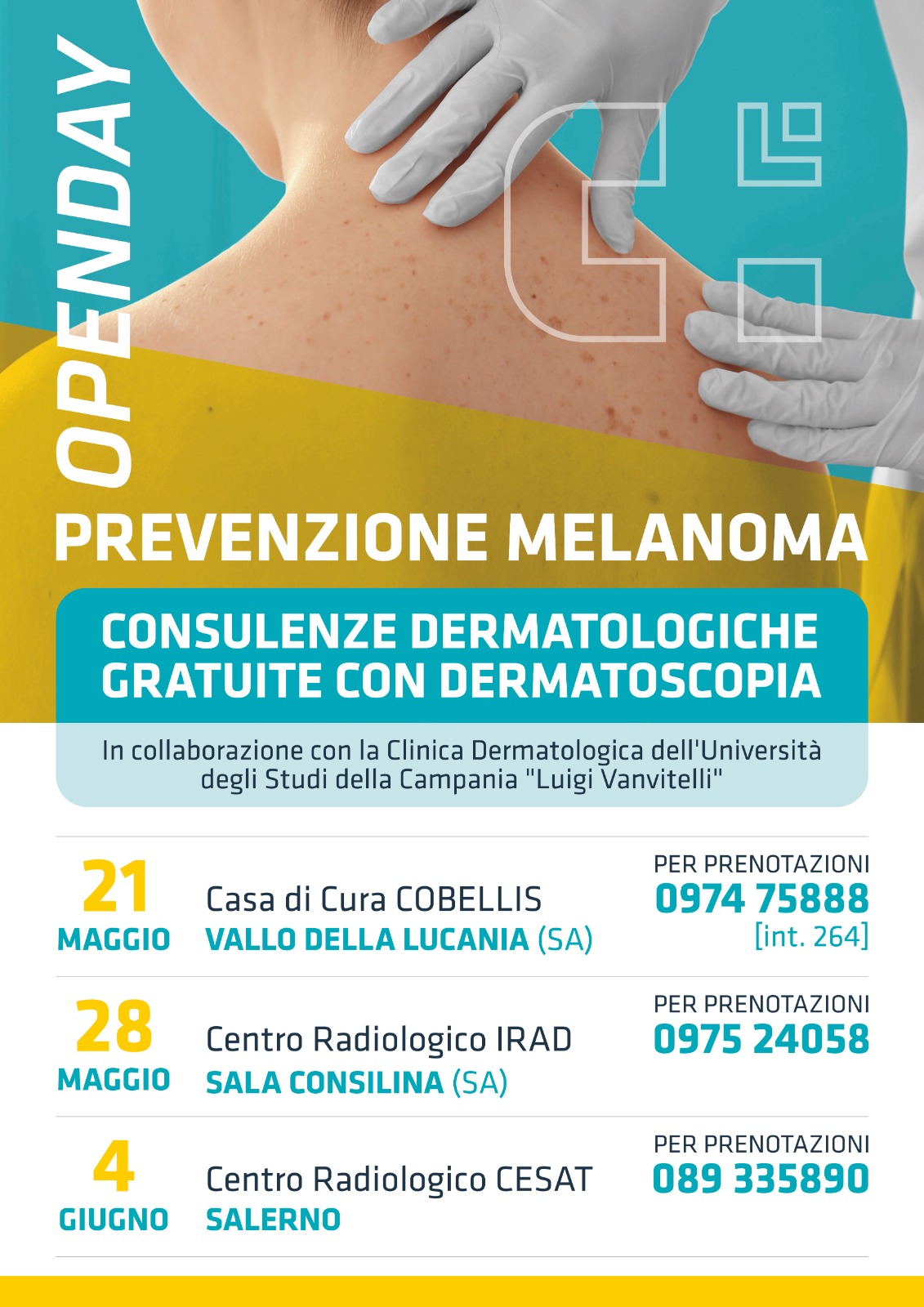 cobellis screening melanoma